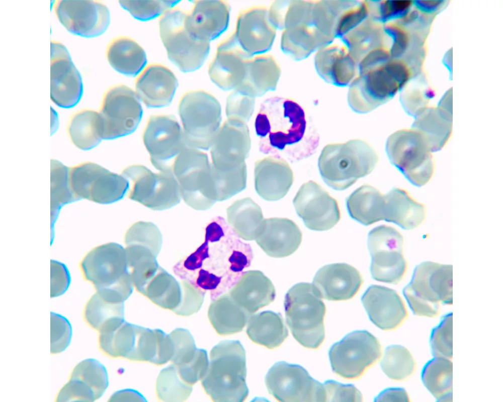 Микроскоп Биологичен цифров MAGUS Bio D230TL LCD 32