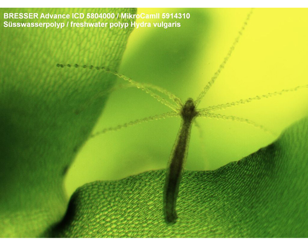 Микроскоп Bresser Advance ICD 10–160x 5