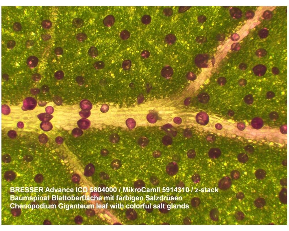Микроскоп Bresser Advance ICD 10–160x 2