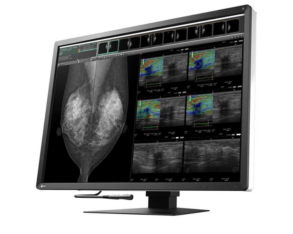 Монитор Медицински монитор EIZO RadiForce RX1270 12MP Цветен 2