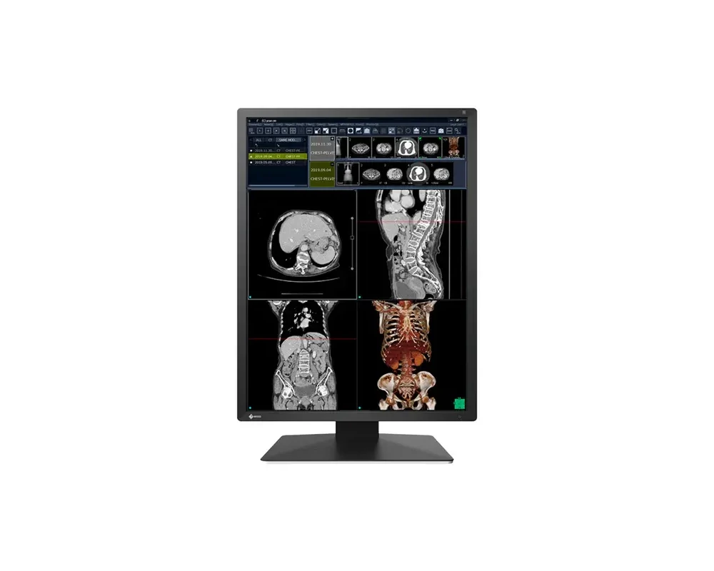 Монитор Медицински монитор EIZO Radi Force RX270 - 21.3" инч, 2MP Цветен LED 5