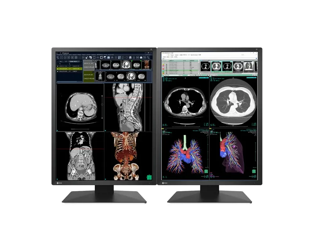 Монитор Медицински монитор EIZO Radi Force RX270 - 21.3" инч, 2MP Цветен LED 6