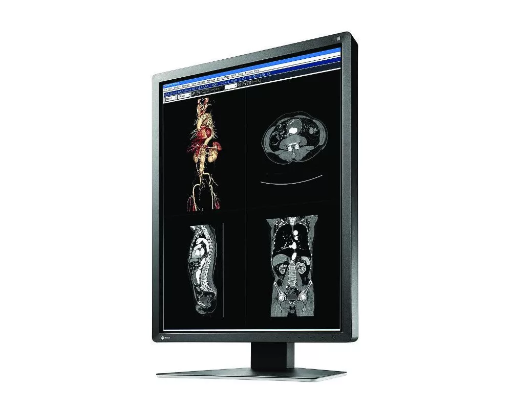 Монитор Медицински монитор EIZO RadiForce MX216-SB 2MP Цветен 3