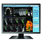 <span>Монитор</span> Медицински монитор EIZO RadiForce MX216-SB 2MP Цветен <span class='catalog-num-in-name'>MX216-SB</span> - 
