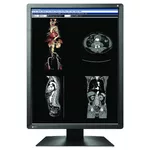 Монитор Медицински монитор EIZO RadiForce MX216-SB 2MP Цветен 2
