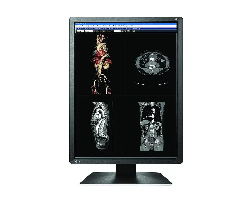 Монитор Медицински монитор EIZO RadiForce MX216-SB 2MP Цветен 2