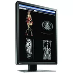 Монитор Медицински монитор EIZO RadiForce MX216-SB 2MP Цветен 4