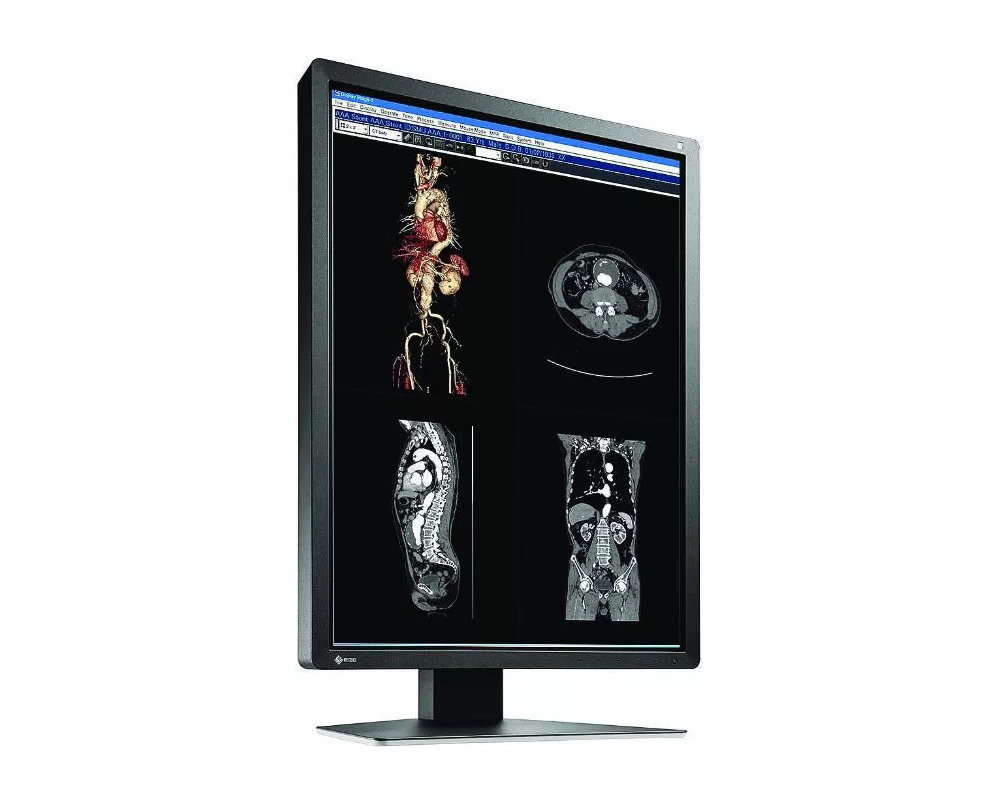 Монитор Медицински монитор EIZO RadiForce MX216-SB 2MP Цветен 4